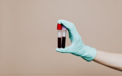 The Life of a Phlebotomy Tech: What To Expect and How to Succeed